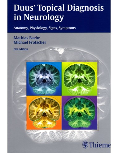 Duus' Topical Diagnosis in Neurology...