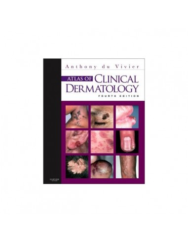 Atlas of Clinical Dermatology 4/e 2013
