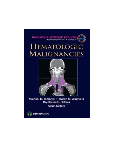 Hematologic Malignancies 1/e 2013