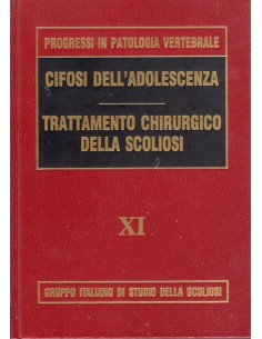 Cifosi...