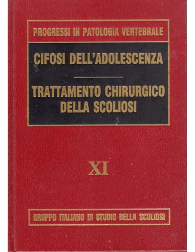 Cifosi dell'adolescenza-trattamento...