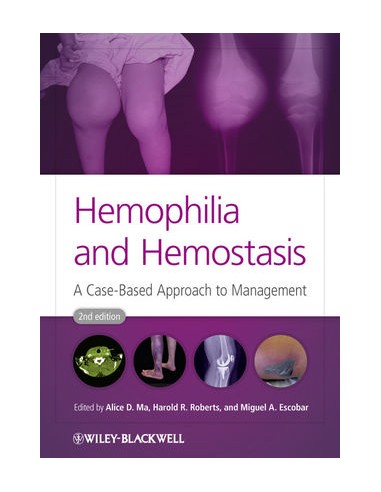 Hemophilia and Hemostasis A...