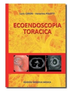 Ecoendoscopia Toracica