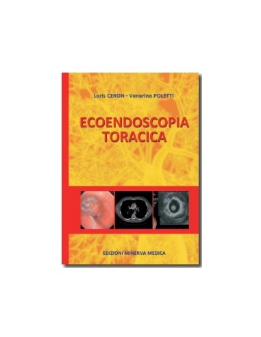 Ecoendoscopia Toracica