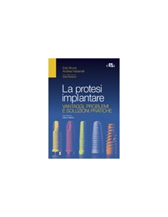 Protesi implantare Vantaggi...