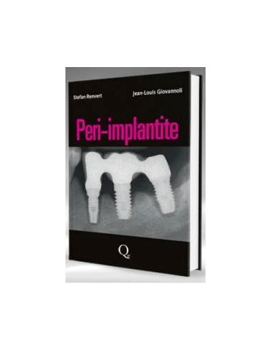 Peri-implantite 1/e 2014