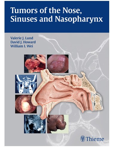 Tumors of the Nose Sinuses and...