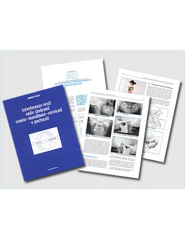Interferenze orali nelle sindromi...