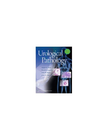 Urological Pathology