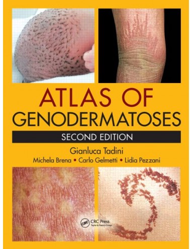 Atlas of Genodermatoses 2/e 2015
