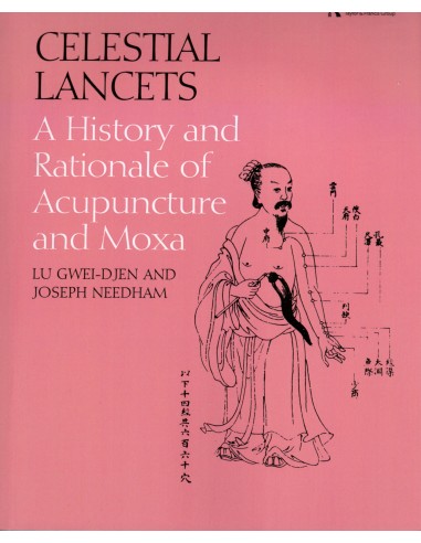 Celestial Lancets:History and...