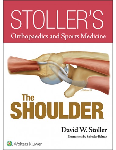 Stoller's Orthopaedics and Sports...