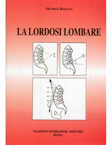 Lordosi lombare (La) 1/e 1997
