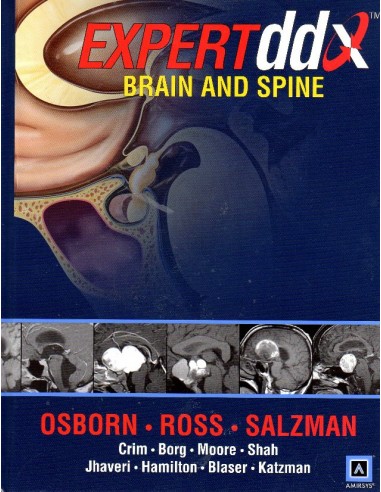 EXPERTddx: Brain and Spine by...