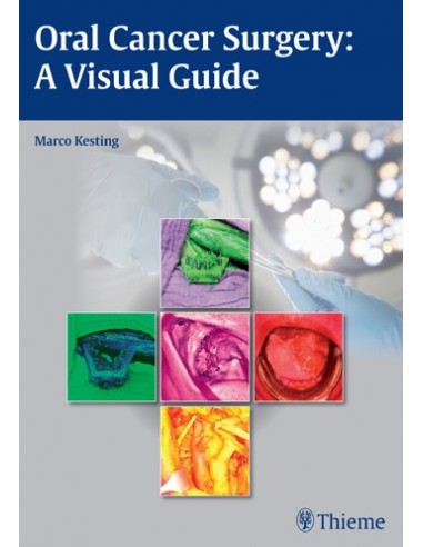 Oral Cancer Surgery a Visual Guide...