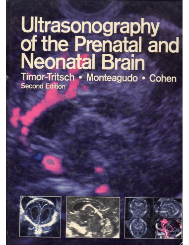 Ultrasonography of the prenatal and...
