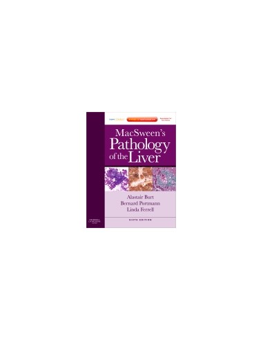 MacSween's Pathology of the Liver 6/e...