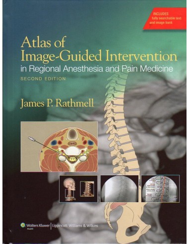 Atlas of Image-Guided Intervention in...