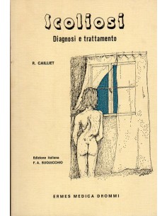 Scoliosi diagnosi e...
