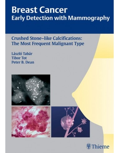 Breast Cancer Early Detection with...