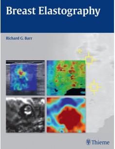 Breast Elastography  1e/2015
