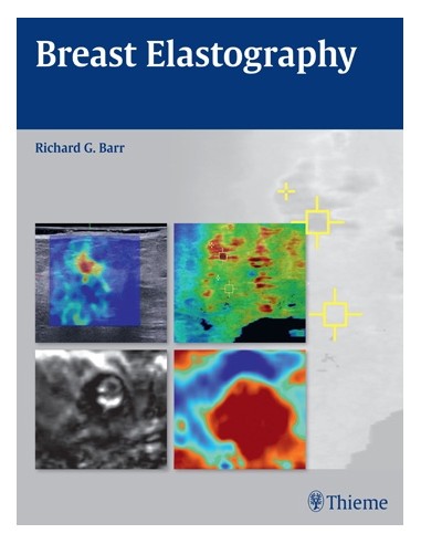 Breast Elastography  1e/2015