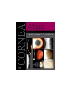 Cornea Atlas 3/e 2013  with...