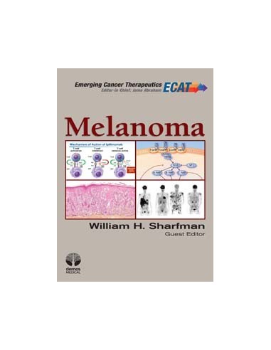 Melanoma