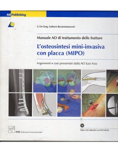 Osteosintesi mini-invasiva...