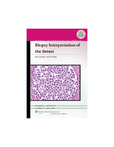 Biopsy Interpretation of the Breast 2/e