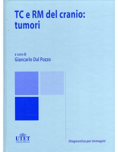 TC e RM del cranio tumori...
