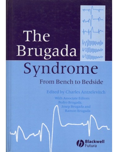 Brugada Syndrome From Bench To Bedside