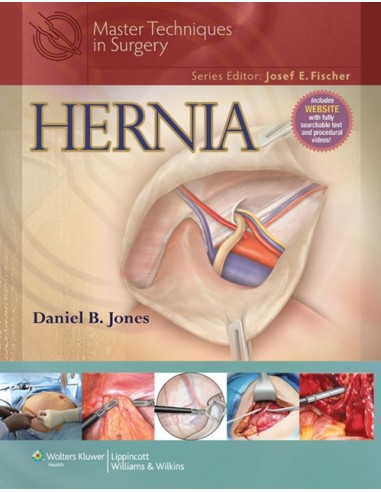 Master Techniques in General Surgery...
