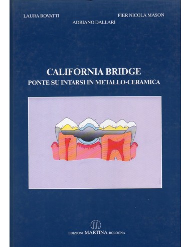 California bridge ponte su intarsi in...