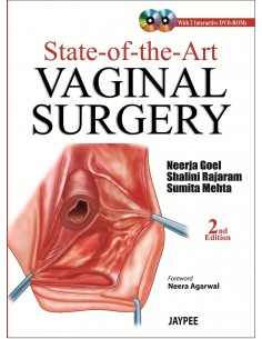 State of the Art Vaginal...