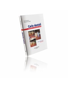 Carie Dentali Malattia e...