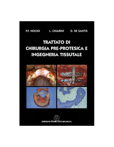 Trattato di Chirurgia pre-protesica e...