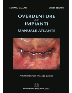 Overdenture su Impianti...