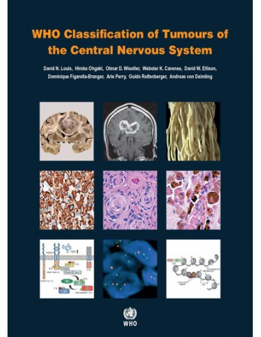 WHO Classification of Tumours of the...