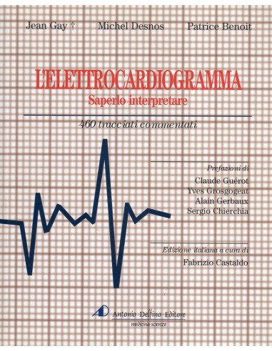 Elettrocardiogramma saperlo interpretare