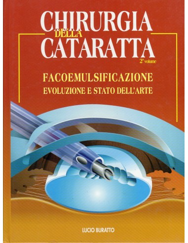 Chirurgia della cataratta 2...