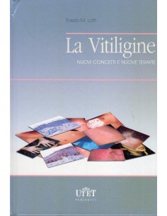 Vitiligine nuovi concetti e...