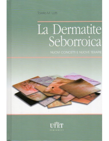 Dermatite seborroica (La) nuovi...