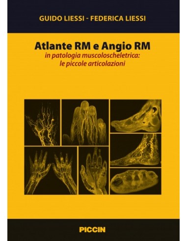 Atlante RM e Angio RM in patologia...