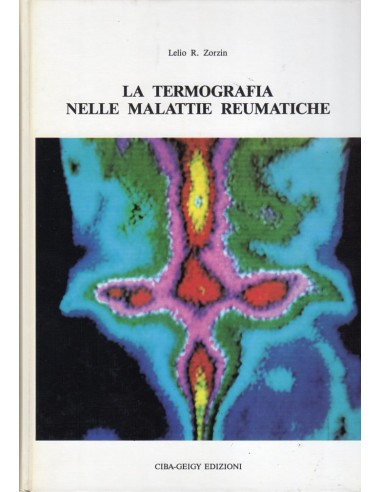Termografia nelle malattie reumatiche