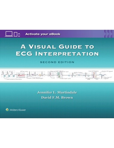 A Visual Guide to ECG Interpretation,...