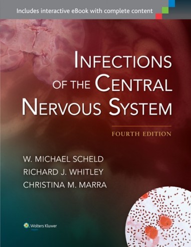 Infections of the Central Nervous...