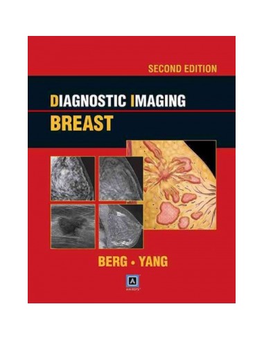 Diagnostic Imaging Breast 2/e 2014