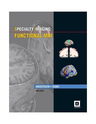 Specialty Imaging Functional MRI