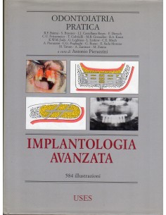 Implantologia avanzata...